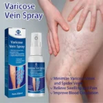 Varicose Veins 30ml Treatment Spray! - Image 3