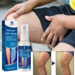 Varicose Veins 30ml Treatment Spray! - Image 4